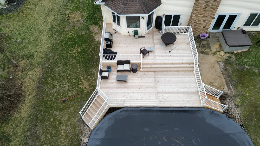Burkhart – Shoreview-facelift-4