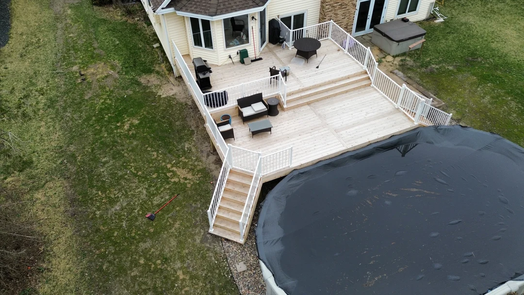 Burkhart – Shoreview-facelift-5